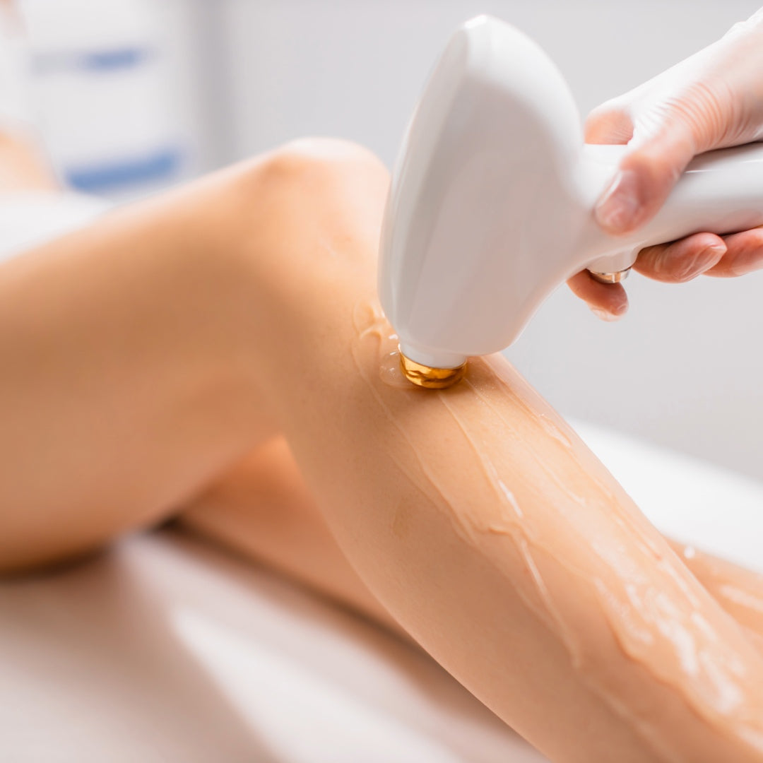 Laser Hair Removal