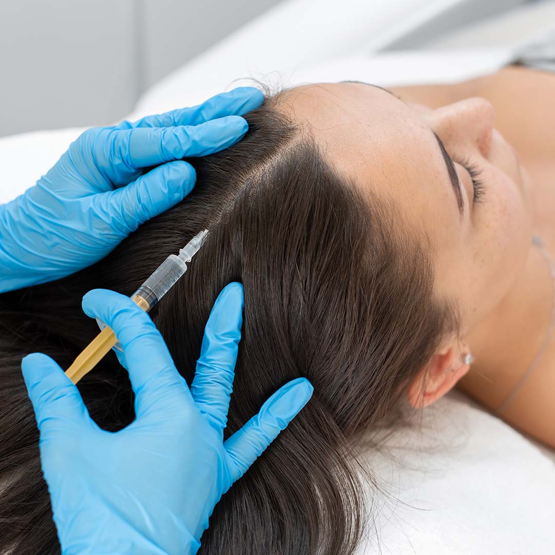 PRP Hair Stimulation
