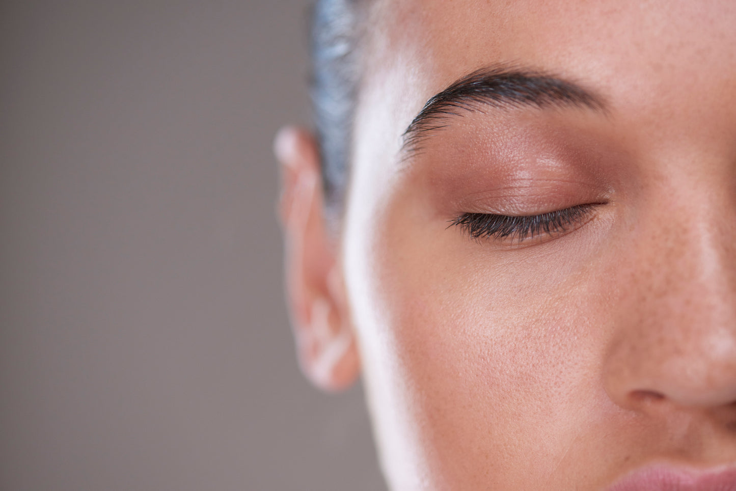 LUMI EYES (Tear Trough Treatment)