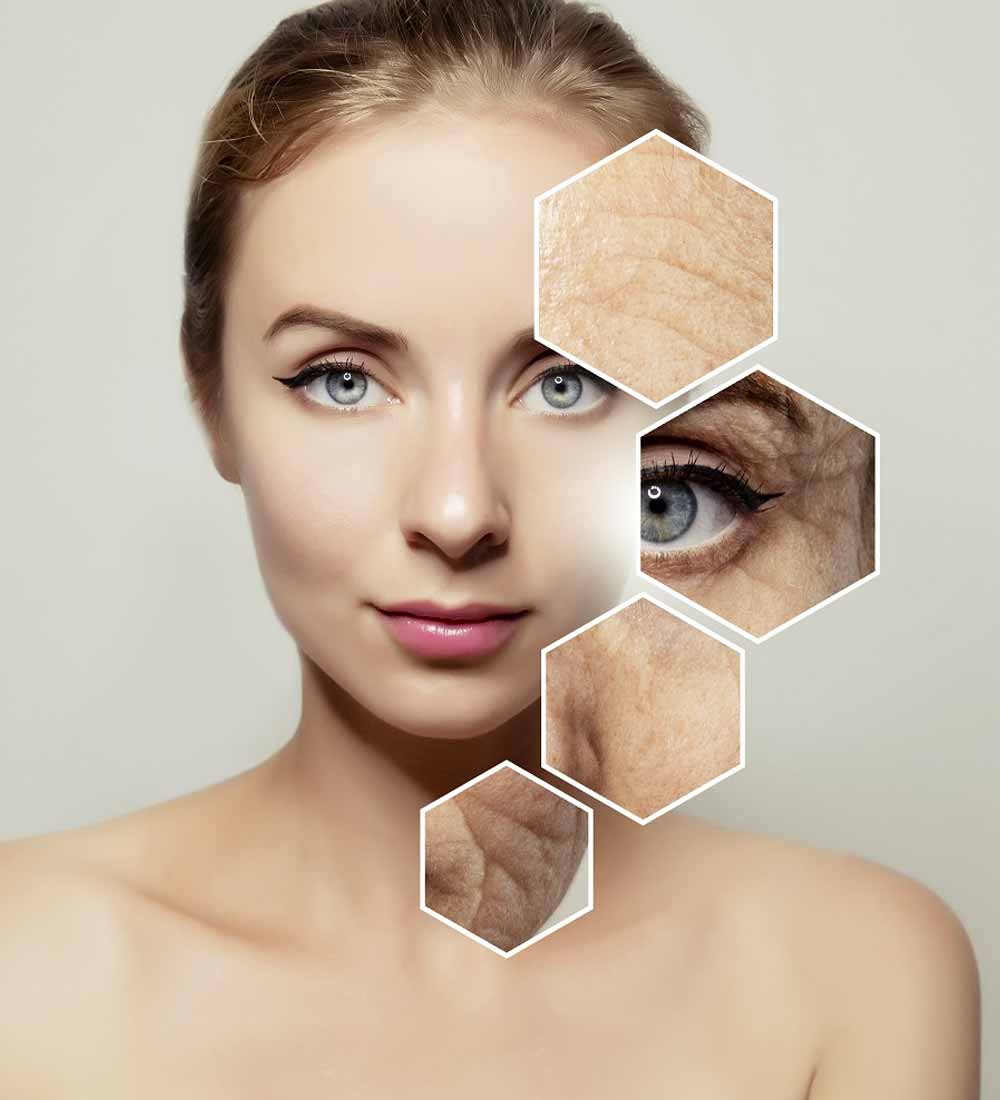 Nordlys IPL Skin Rejuvenation