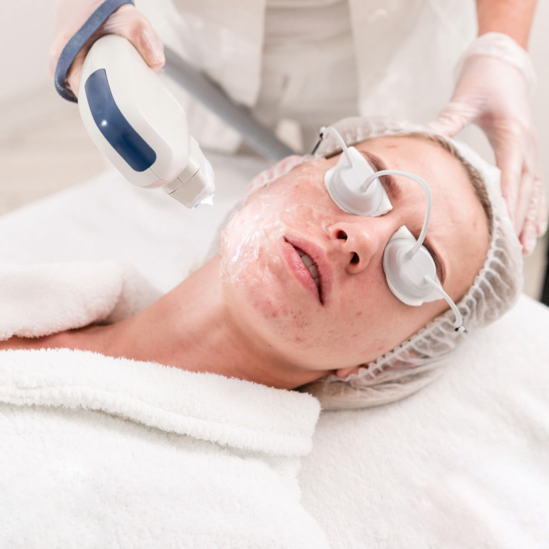 Acne Treatment