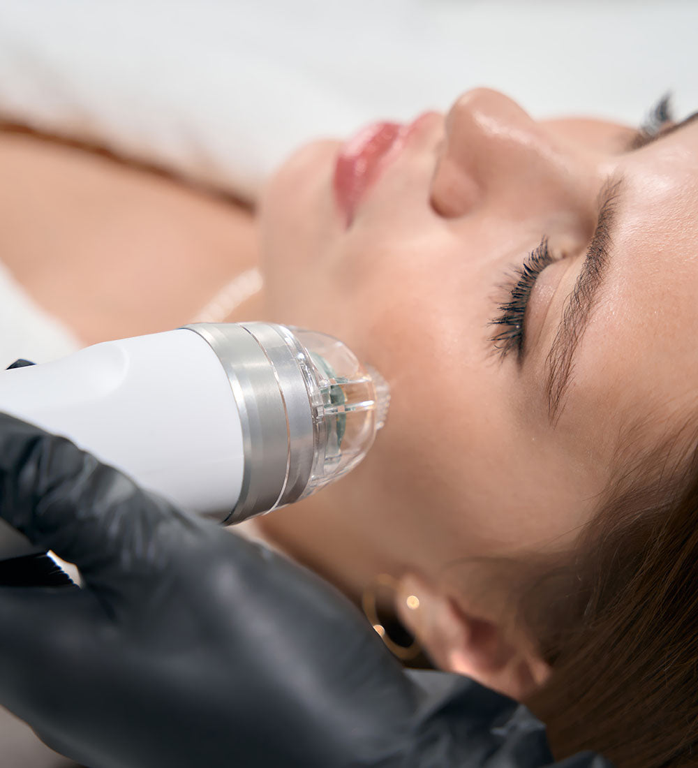 Matrix Pro RF Microneedling