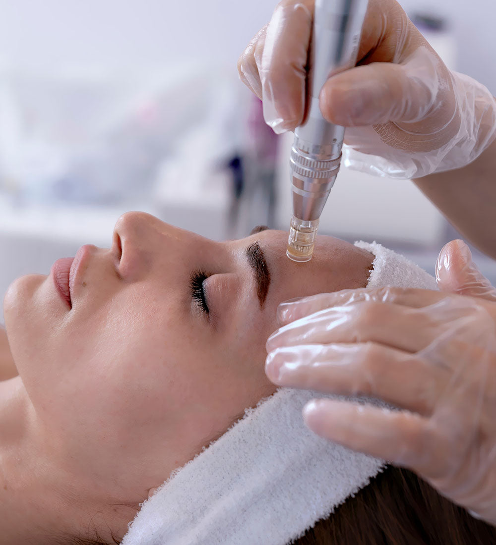 Microneedling Dermapen4