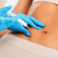Profhilo Body -