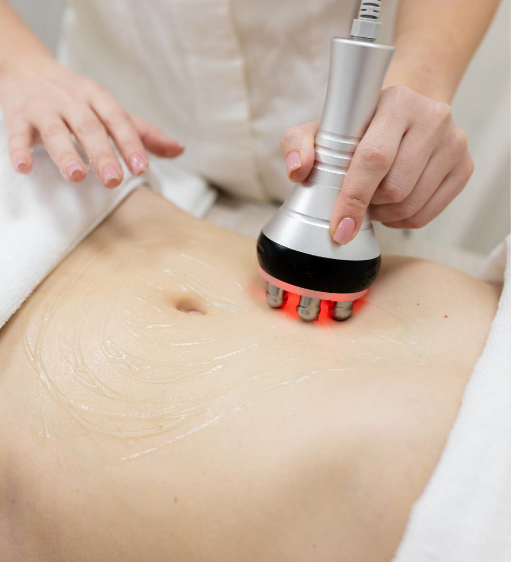 Radiofrequency Skin Tightening