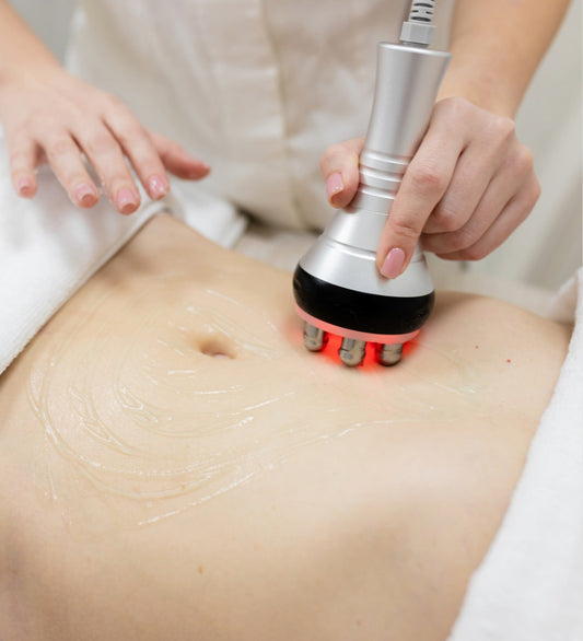 Radiofrequency Skin Tightening