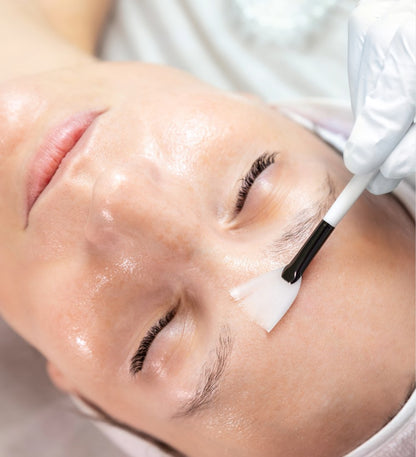 VI Skin Peel