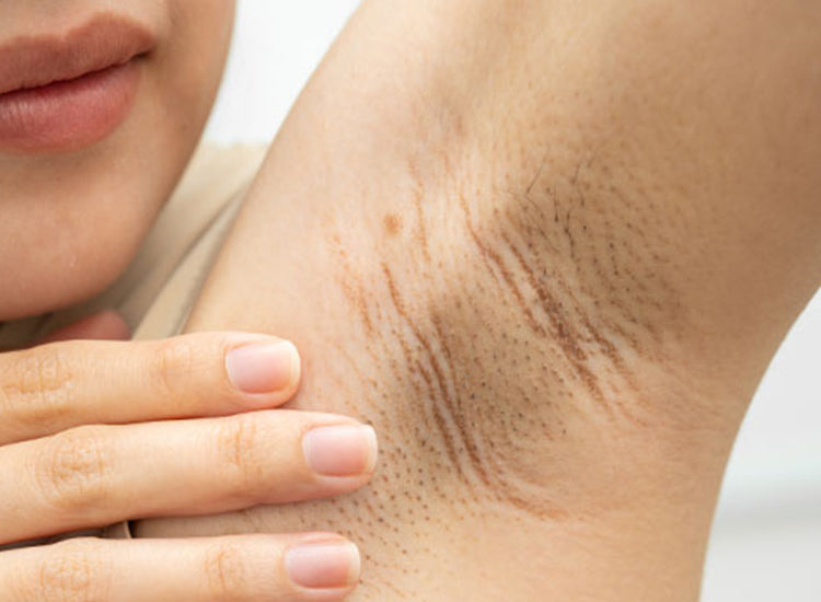 DÉCAAR Deep Phyto Peel