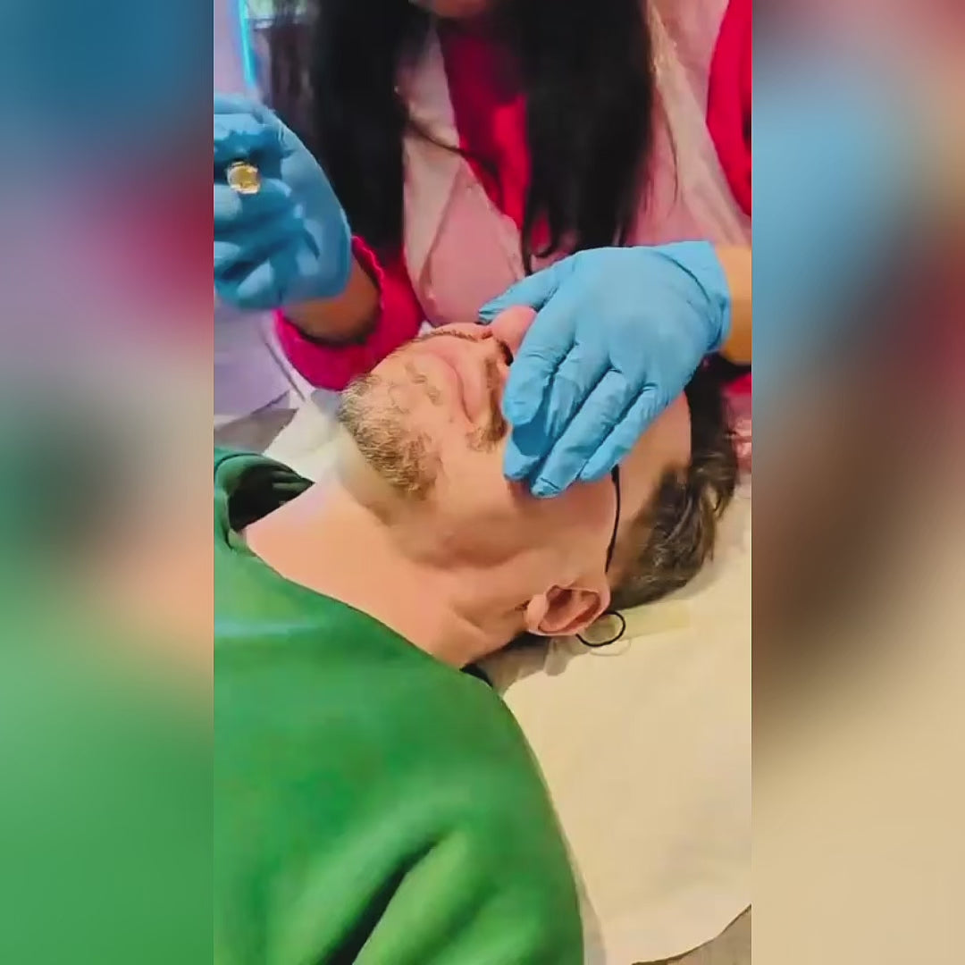 Thread Vein Removal