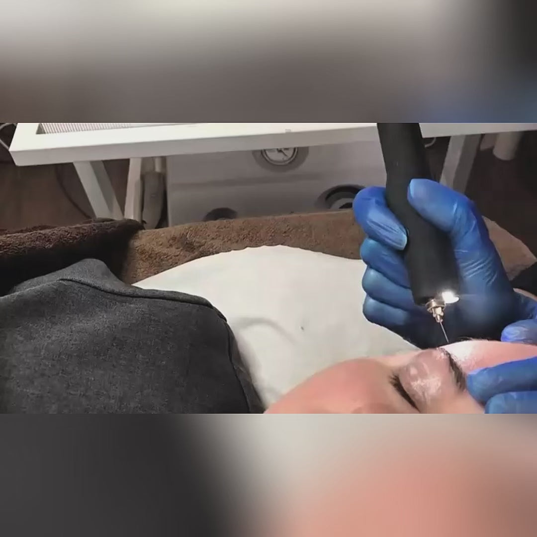 ACCOR Plasma Pen
