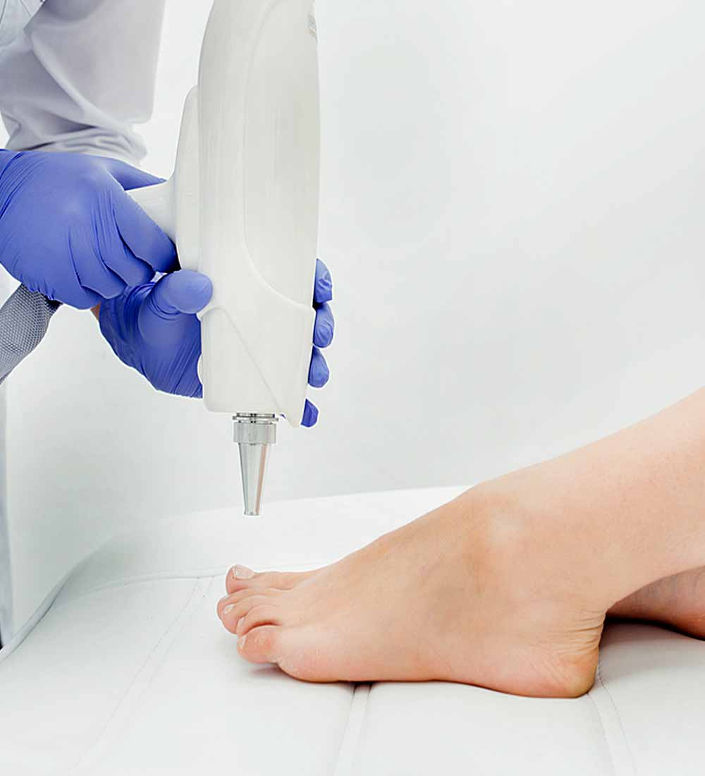 Laser Podiatry