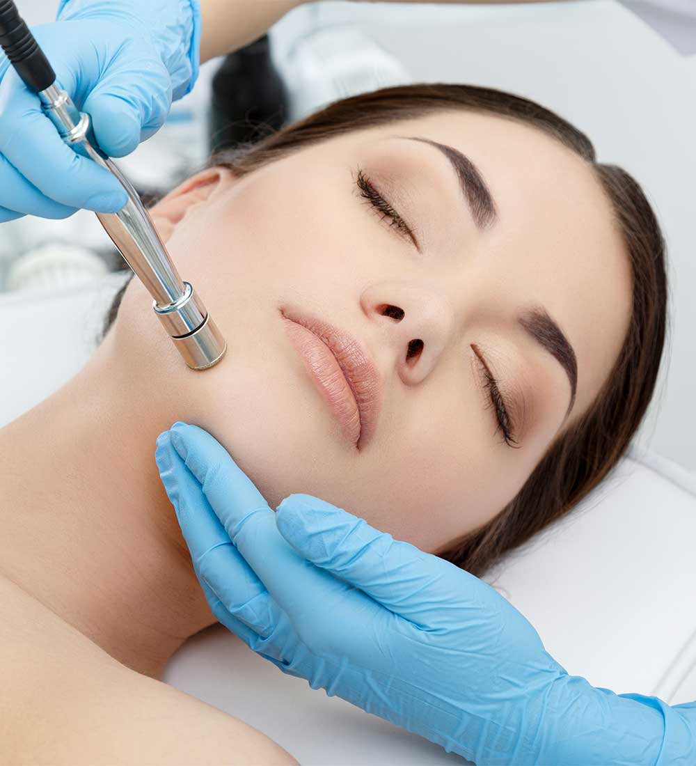 Microdermabrasion