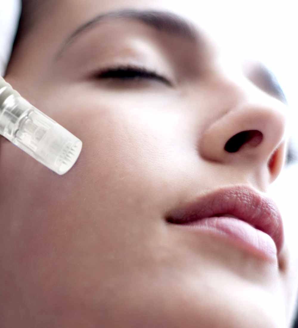 Microneedling Dermapen 4