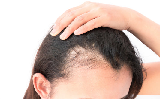 PRP Hair Loss Treatments (Platelet Rich Plasma)